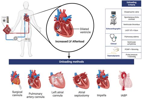 lv unloading ecmo|left ventricle effusion ecmo.